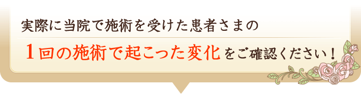 実際にNODA整体院で施術を受けた患者様の１回の施術で起こった変化をご確認ください